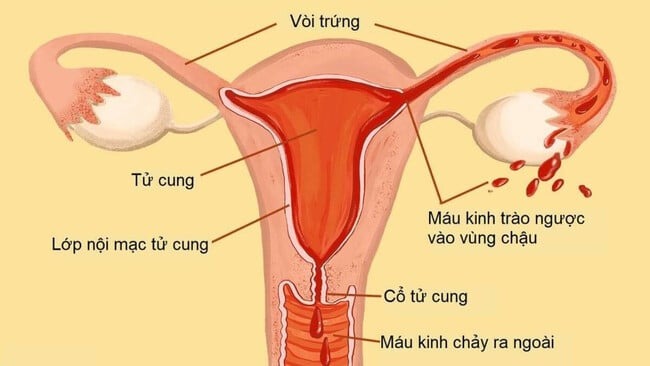 Tác hại của cốc nguyệt san Gallery 2