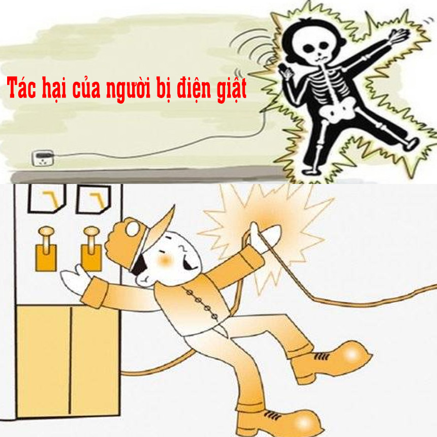Điện giật là gì? Gallery 2