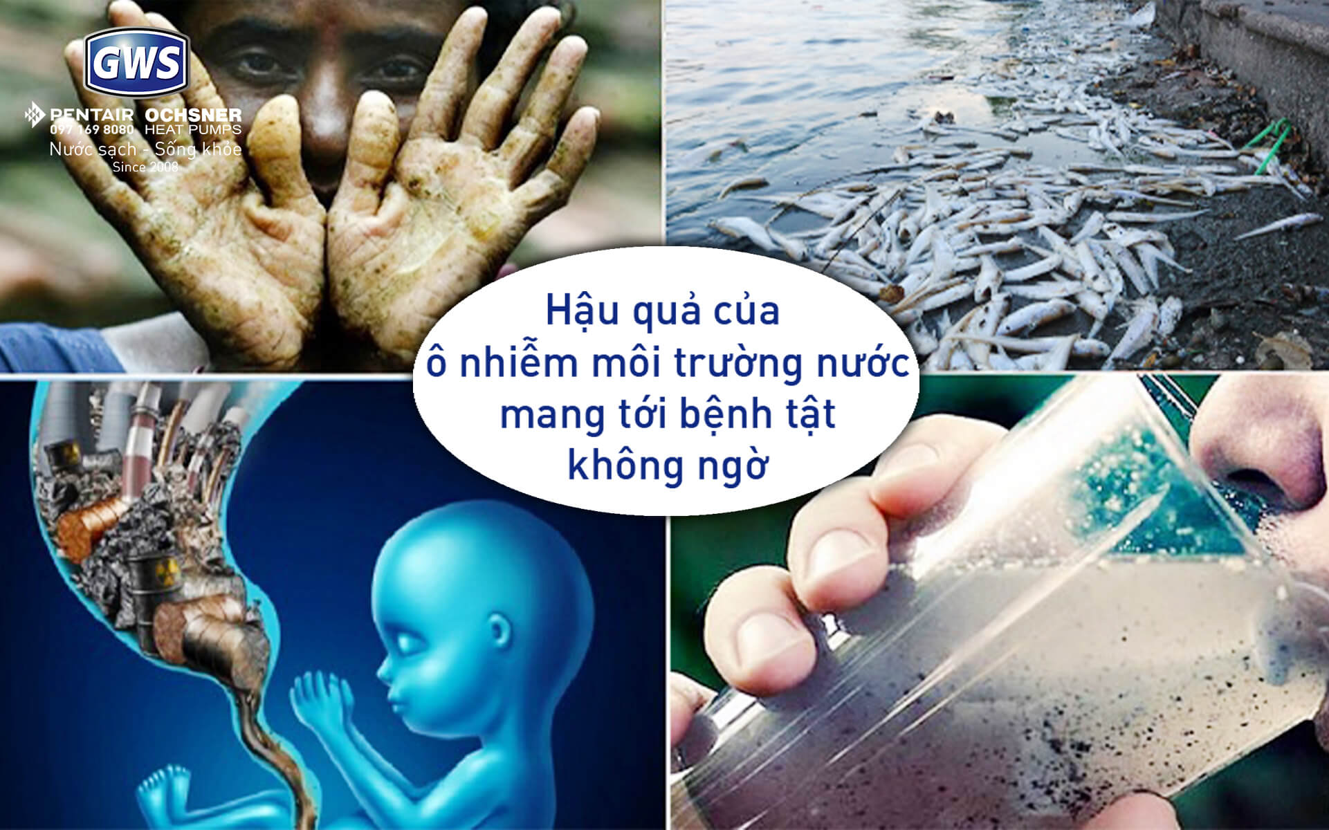 Tác hại của ô nhiễm nước Gallery 2