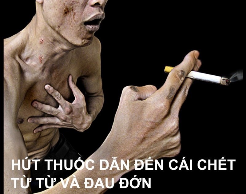 Thuốc gây nghiện là gì? Gallery 2