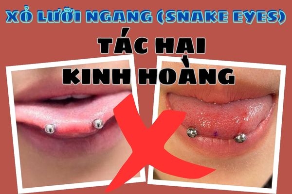 Xin xỏ là gì? Gallery 2