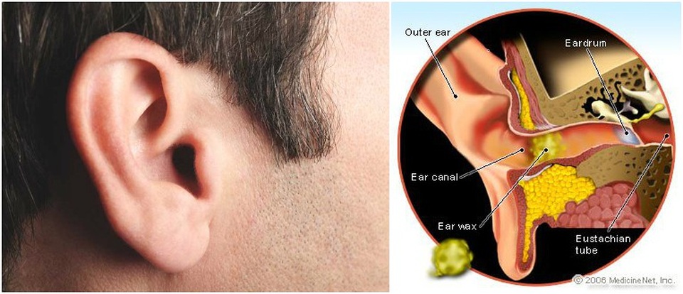 Tại Sao Lại Có Ráy Tai?