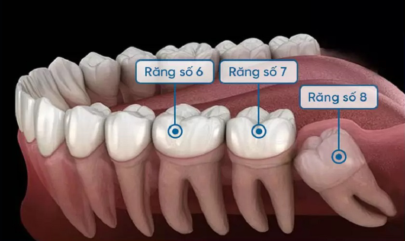 Tại Sao Lại Gọi Là Răng Khôn?