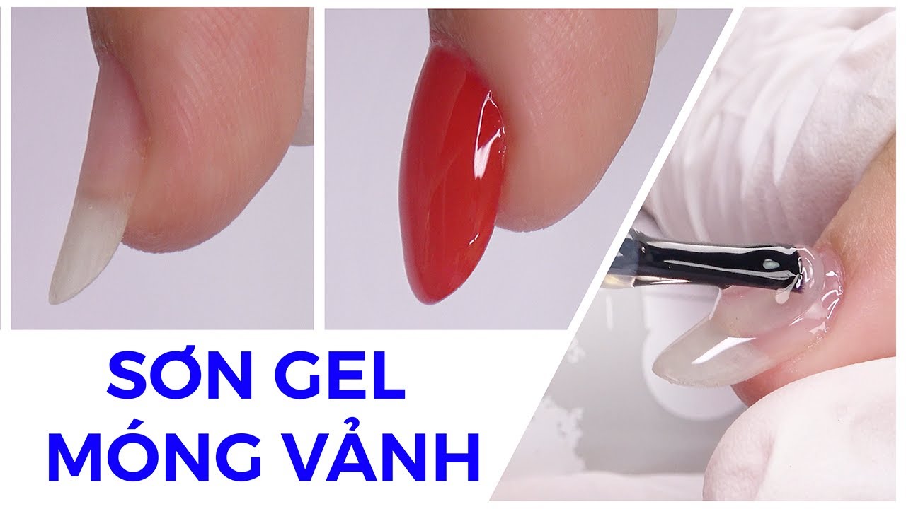 Tại Sao Móng Tay Bị Vểnh?