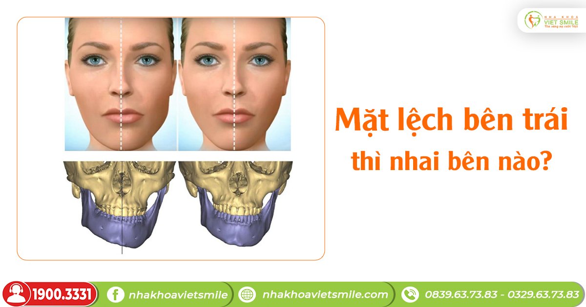 Nằm nghiêng bên trái thì mặt lệch bên nào? Gallery 1