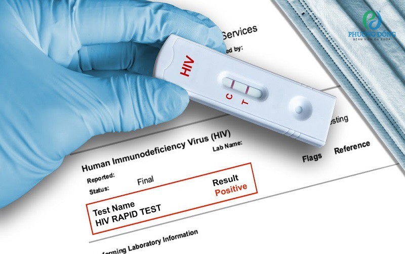 Xét nghiệm HIV sau 2 tuần có chính xác không? Gallery 2