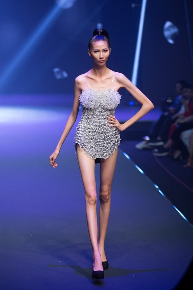 Người Mẫu Gầy Nhất Thế Giới Là Ai? Gallery 2