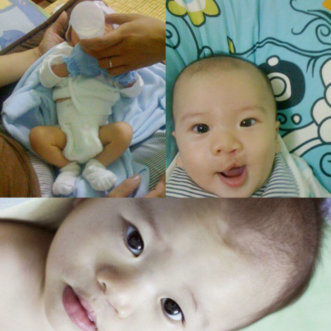 Tâm sự của mẹ có con bị sứt môi: Chuyến hành trình đầy nước mắt và hy vọng
