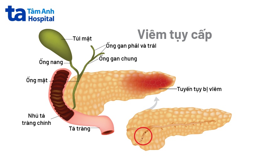 Tận Tuỵ Là Gì?