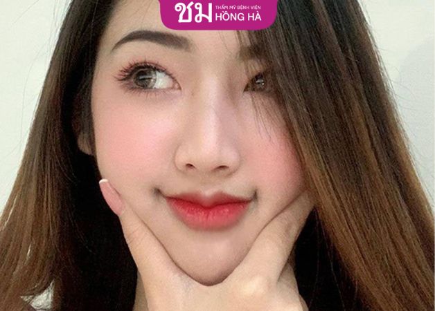 Tạo Khóe Môi Cười Tại Nhà