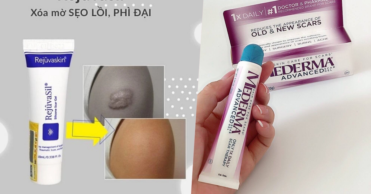 Thai Scar Có Tốt Không? Gallery 2