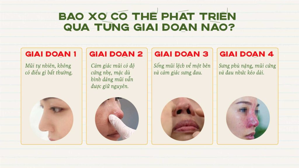 Xơ múi là gì? Gallery 1