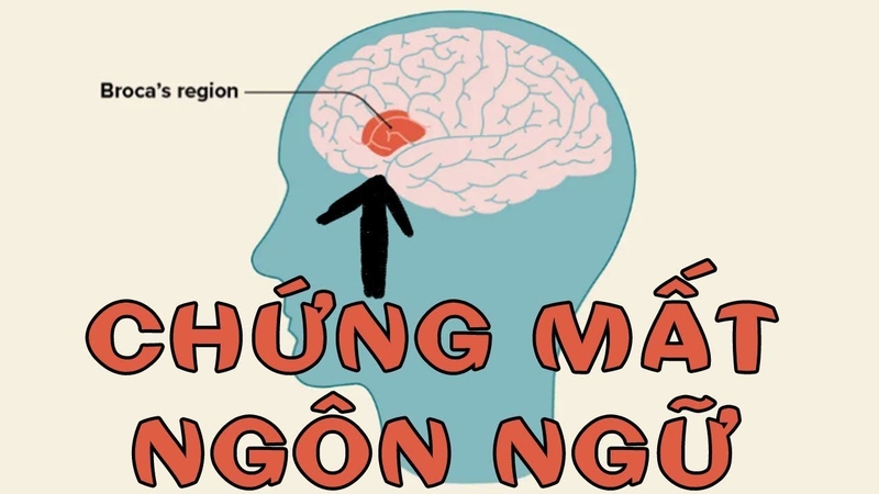 Thất ngôn là gì?