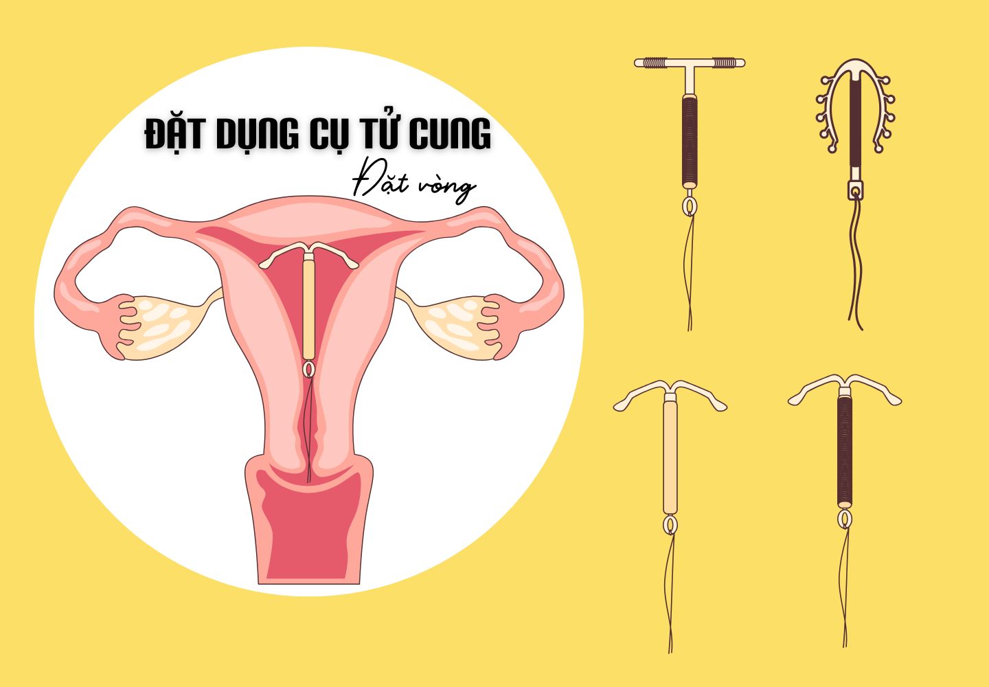 Theo dõi sử dụng BPTT là gì?