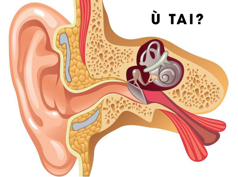 Thỉnh Thoảng Bị Ú Tai: Nguyên Nhân, Triệu Chứng Và Cách Xử Lý