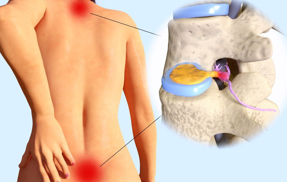 Thỉnh Thoảng Đau Như Kim Châm Là Gì? Nguyên Nhân Và Cách Điều Trị