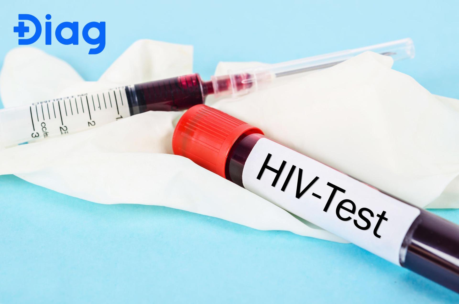 Xét nghiệm HIV sau 2 tuần có chính xác không? Gallery 1