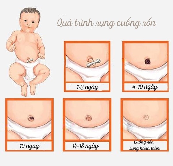 Thời Gian Rụng Rốn: Khi Nào Bé Bắt Đầu Rụng Rốn?