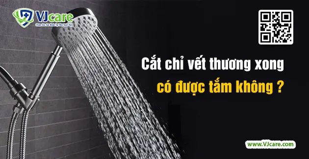 Cắt chỉ xong có được tắm không? Gallery 1