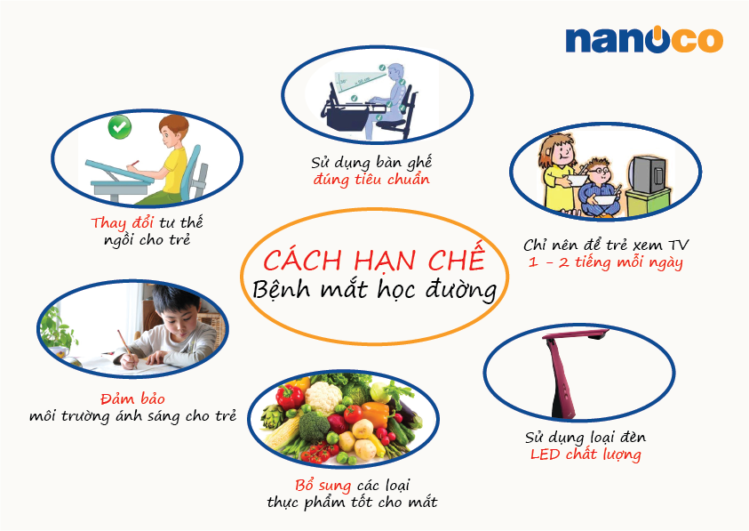 Cách Hạn Chế Tăng Độ Cận Gallery 1