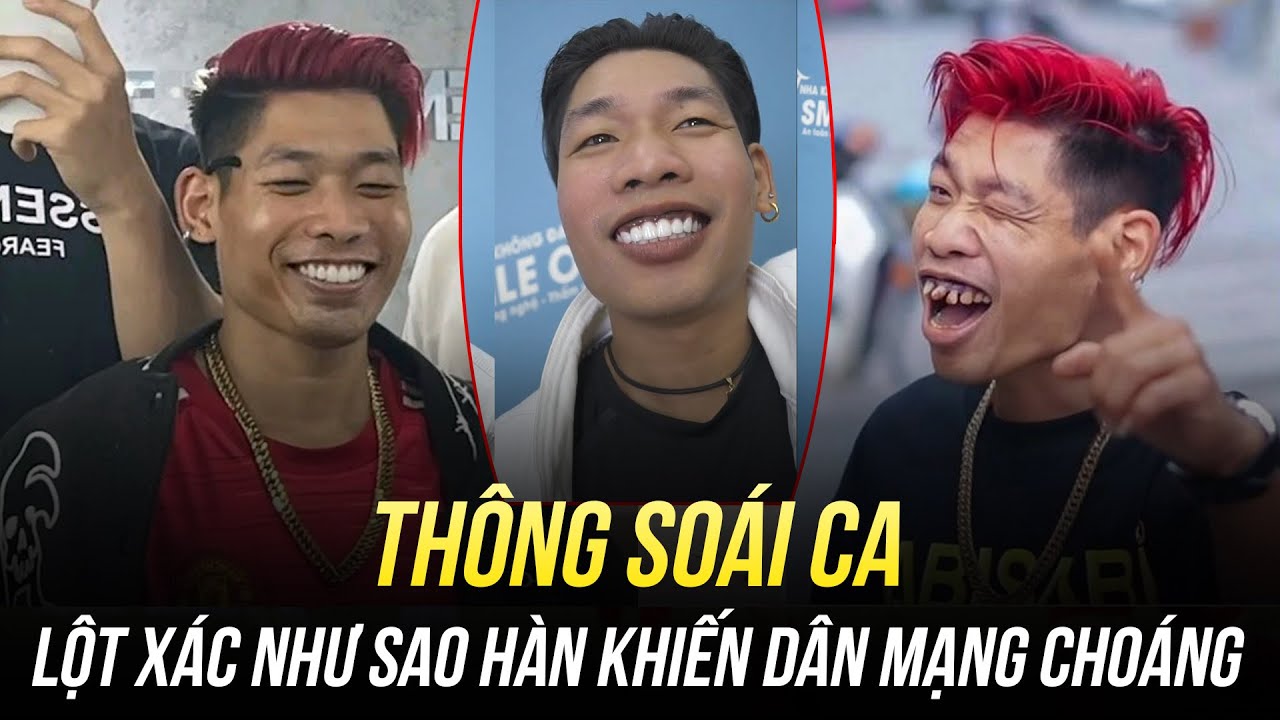Thông Soái Ca Làm Răng: Hướng Dẫn Chi Tiết & Bí Quyết Cho Nụ Cười Tỏa Sáng