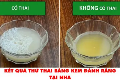 Thử nước tiểu với kem đánh răng: Sự thật và nguy cơ Gallery 2
