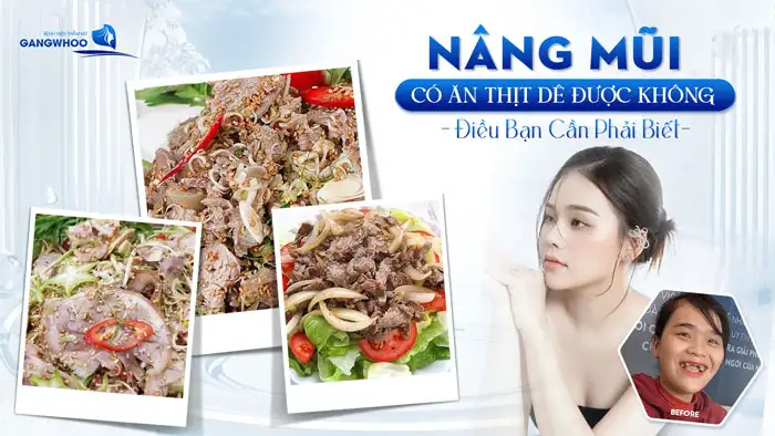 Nâng mũi ăn thịt dê được không? Gallery 1