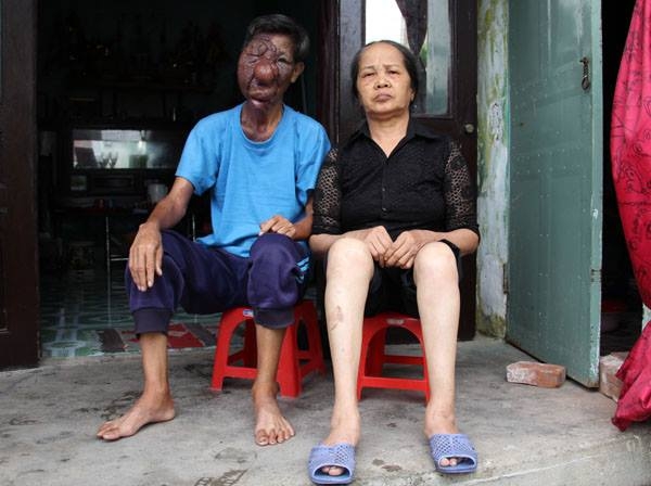 Ông Lão Ăn Xin: Cuộc Sống Khó Khăn Và Những Câu Chuyện Đáng Suy Ngẫm Gallery 1