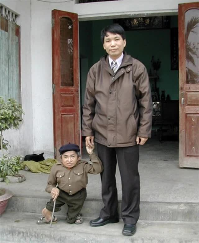 Người Lùn Việt Nam: Thực trạng, thách thức và cơ hội Gallery 1