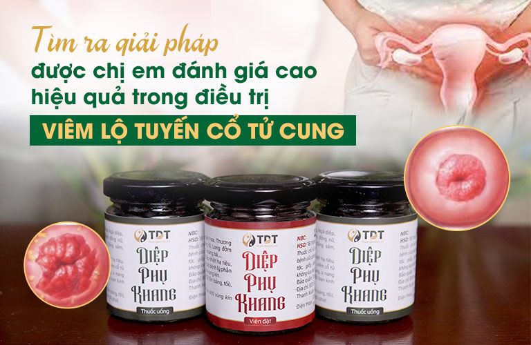 Thuốc Diệp Phụ Khang Giá Bao Nhiêu?