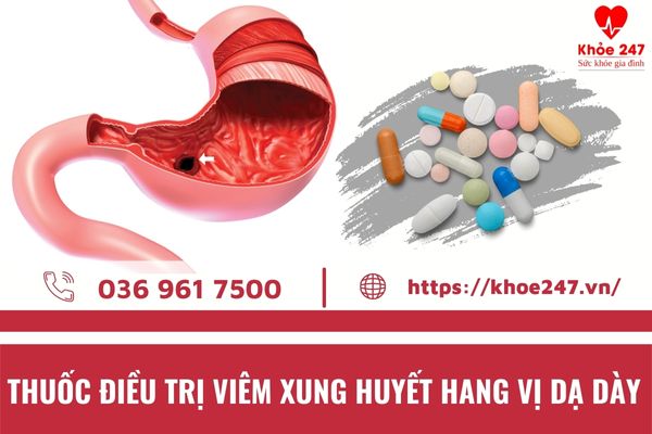 Thuốc Nam Trị Viêm Xung Huyết Hang Vị Gallery 2