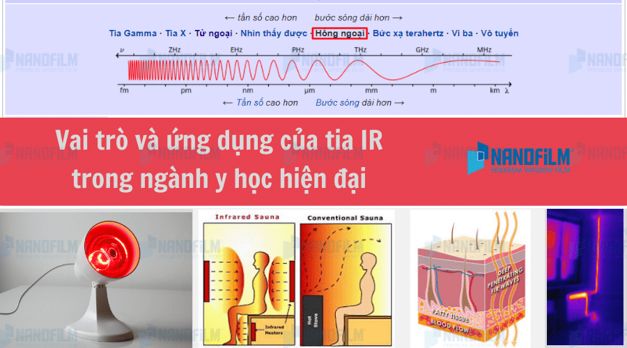 Tia IR là gì?