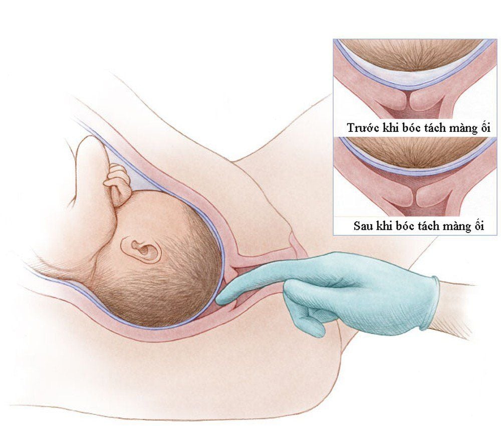 Tia ối là gì?