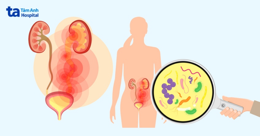 Tiểu Rắt Sau Quan Hệ: Nguyên Nhân, Cách Khắc Phục và Phòng Ngừa