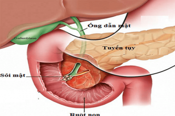 Tiều Tụy Là Gì?