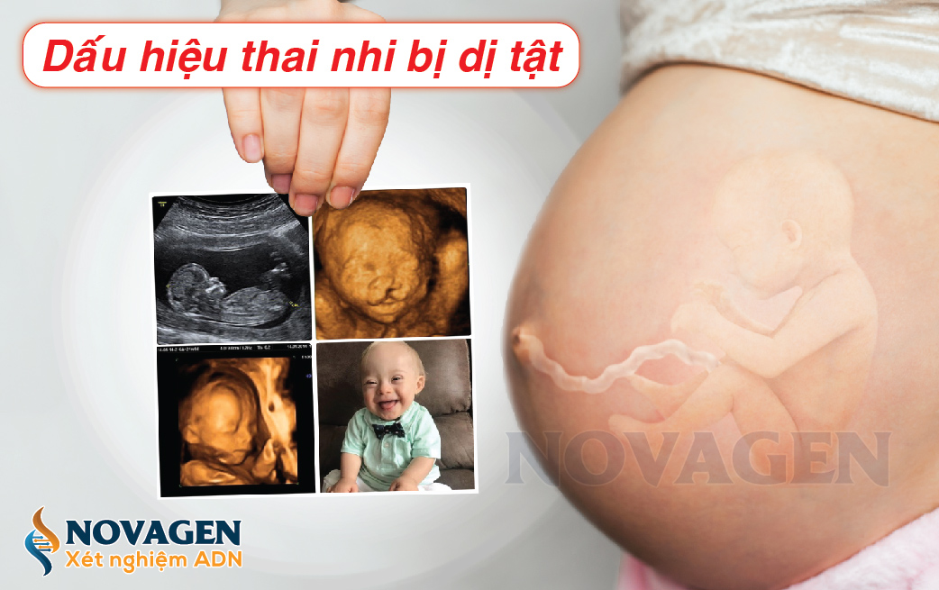 Thai bị dị tật phải làm sao? Gallery 1