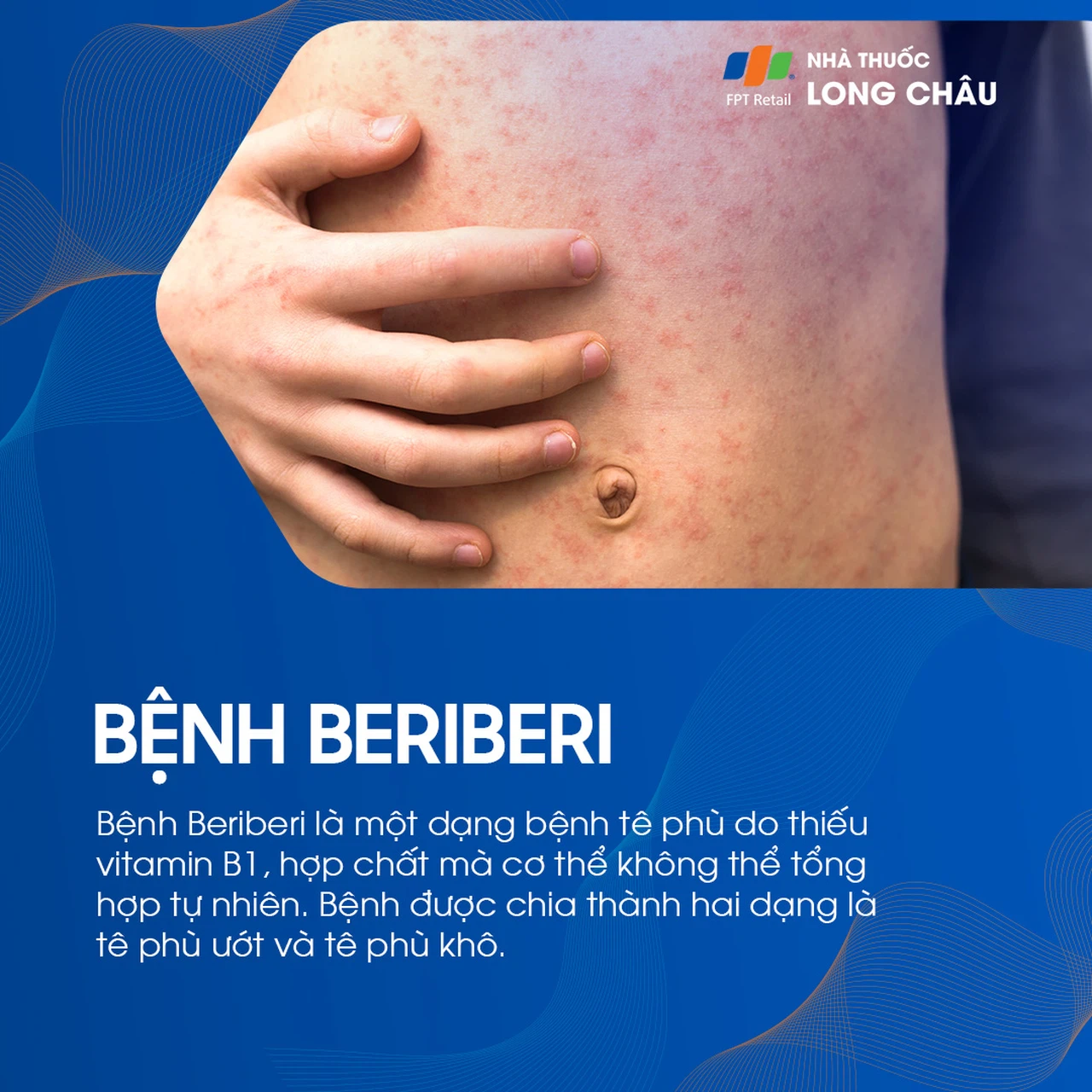 Beri có tác dụng với nước không? Gallery 2