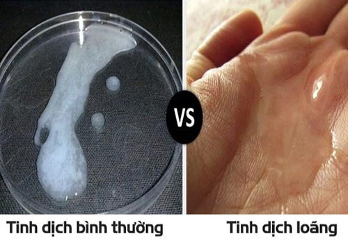 Tinh dịch loãng hay đặc thì tốt? Gallery 2
