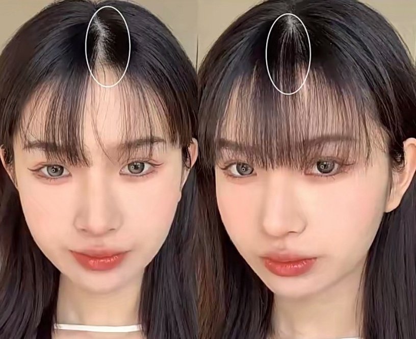Tóc mái bị vểnh: Nguyên nhân và cách khắc phục hiệu quả Gallery 2