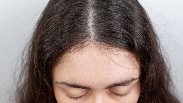Tóc Rễ Tre Là Gì?