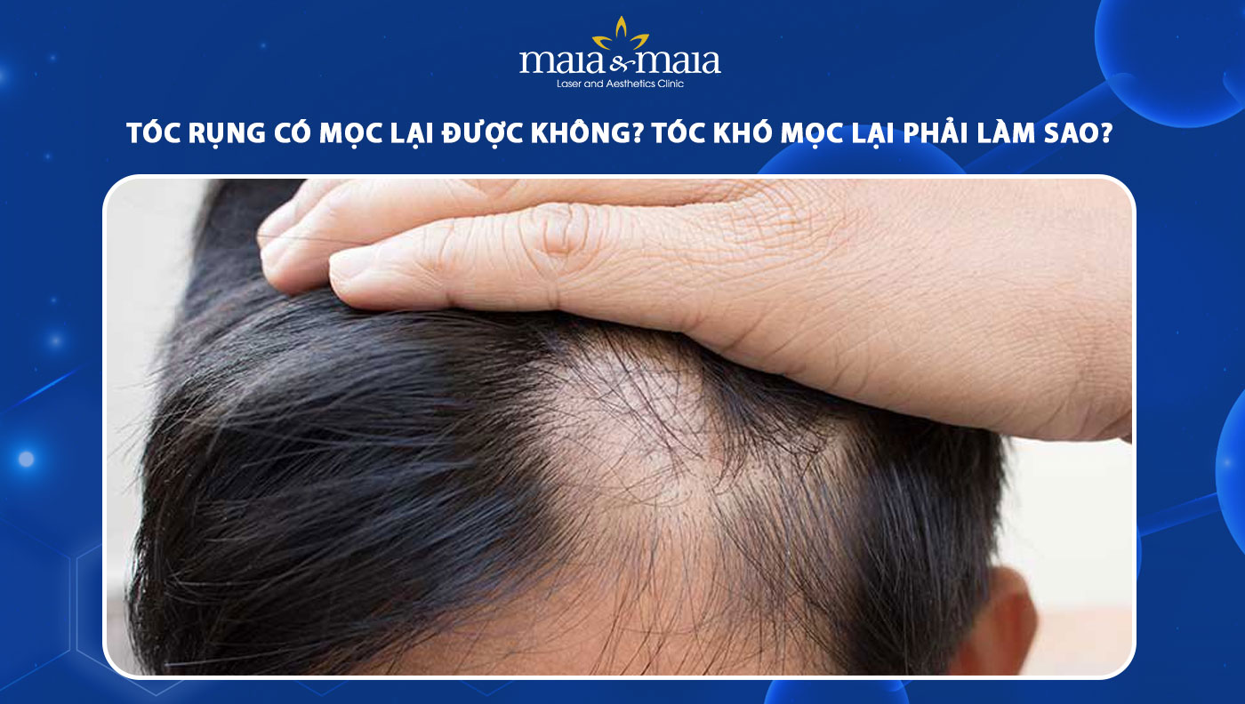 Tóc rụng có mọc lại không?