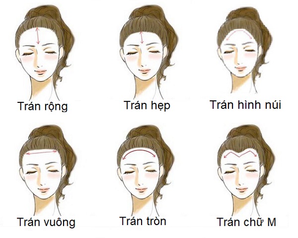 Trán rộng là như thế nào?