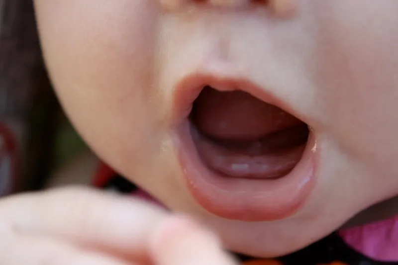 Trẻ 7 Tháng Chưa Mọc Răng: Có Gì Đáng Lo Ngại?