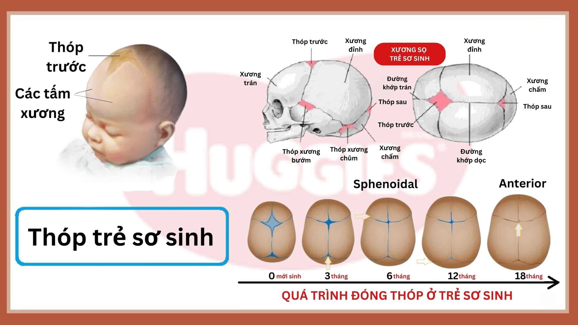 Trẻ Bao Nhiêu Tháng Đóng Thóp?