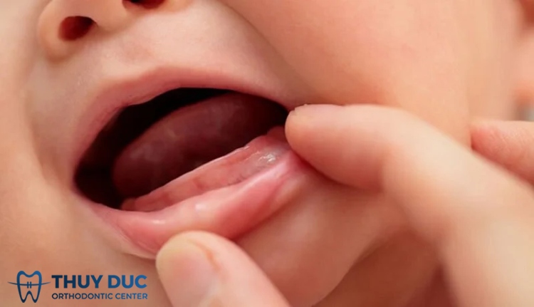 Trẻ chậm mọc răng nên bổ sung gì?