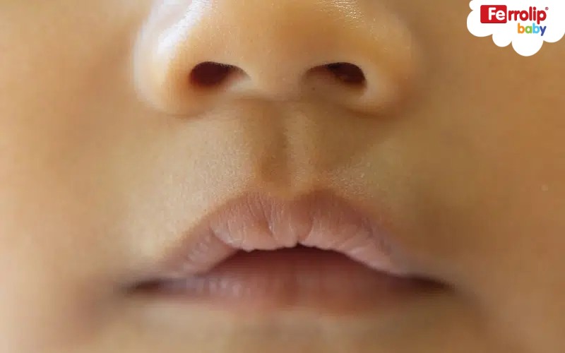 Trẻ Môi Nhợt Nhạt: Nguyên Nhân và Cách Xử Lý