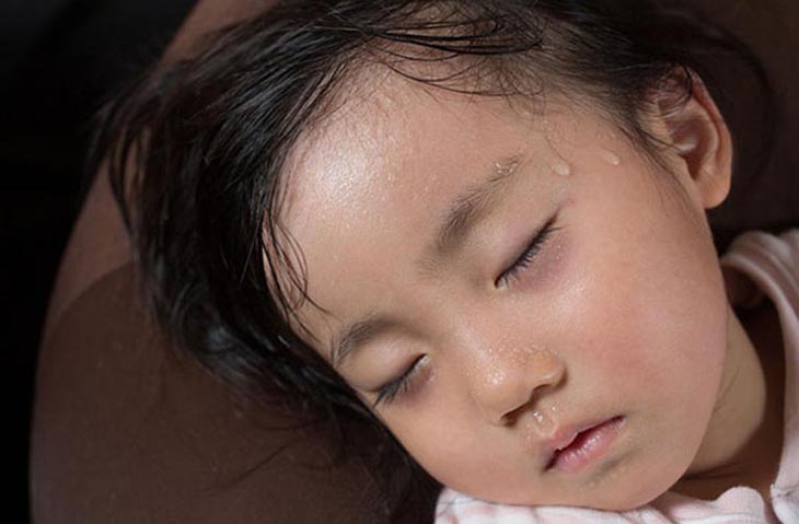 Trẻ ngủ toát mồ hôi đầu: Nguyên nhân và cách xử lý