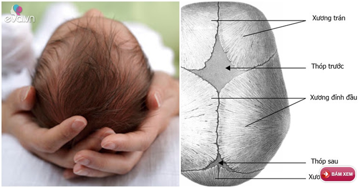 Trẻ sinh ra thóp đã đầy: Nguyên nhân và cách xử trí