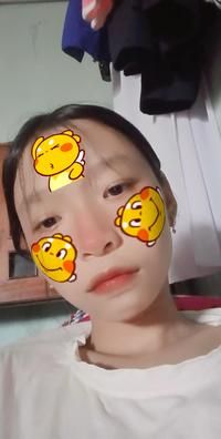 Trên trời có giếng nước trong con kiến chẳng lọt con ong chẳng vào là quả gì? Gallery 2