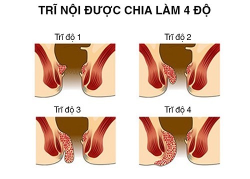 Tri Do Dai Là Gì? Gallery 2